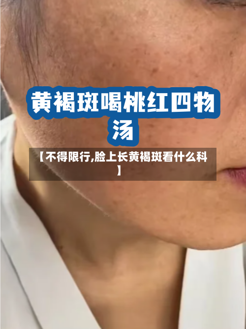 【不得限行,脸上长黄褐斑看什么科】